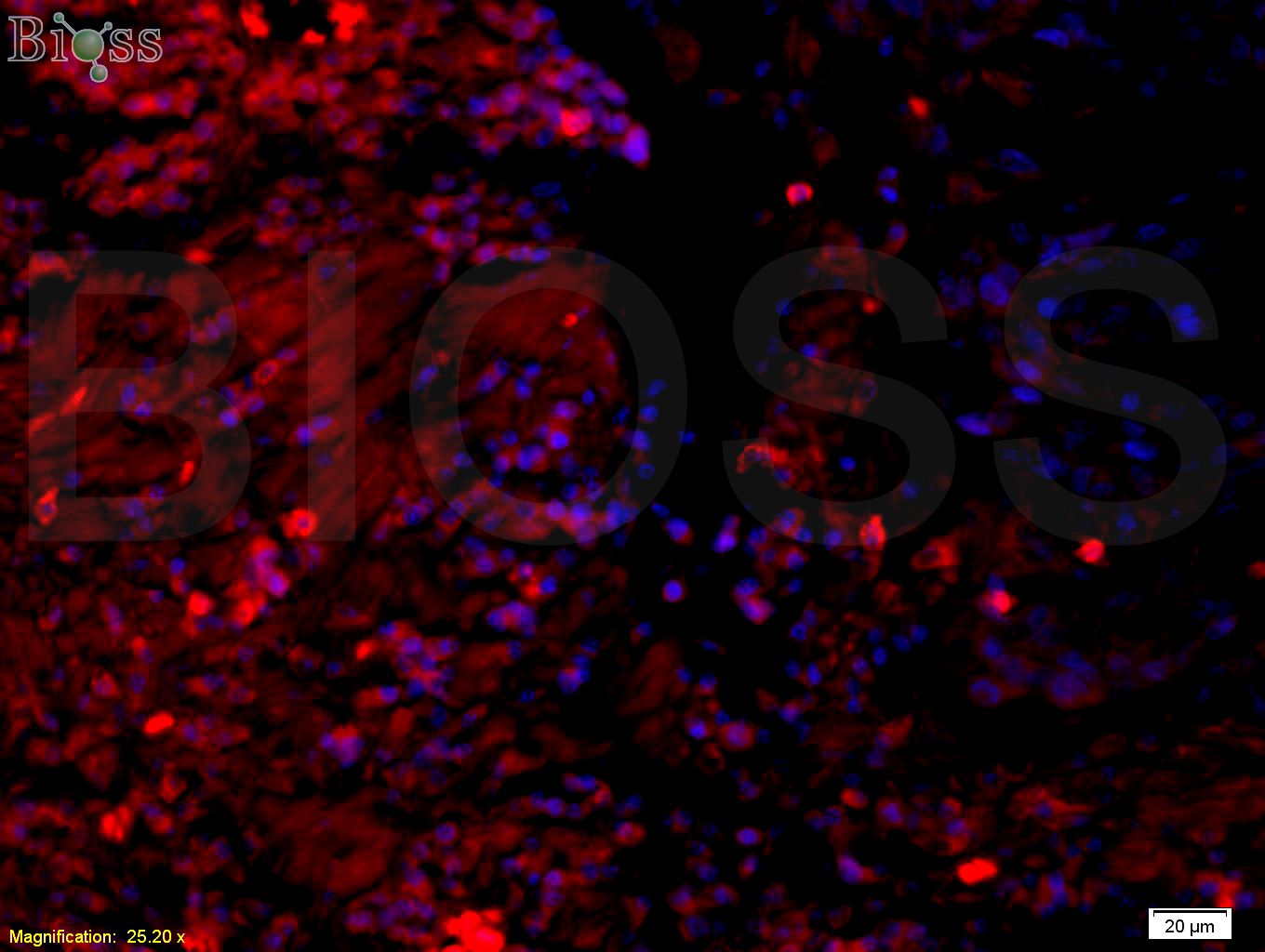 14-3-3蛋白/14-3-3 α/β/γ/δ/ε亚型抗体-bs-0237R